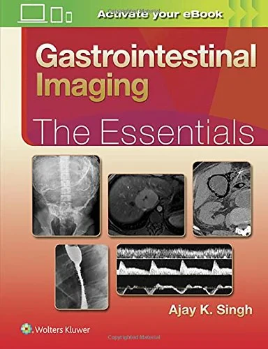 Coperta cărții "Gastrointestinal Imaging: The Essentials (Essentials Series)" de autor necunoscut