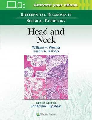 Coperta cărții "Differential Diagnoses in Surgical Pathology: Head and Neck" de autor necunoscut