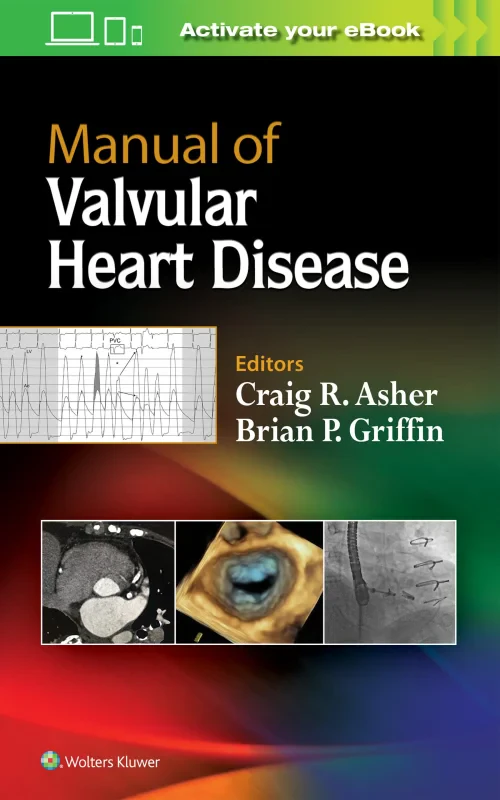 Coperta cărții "Manual of Valvular Heart Disease" de autor necunoscut