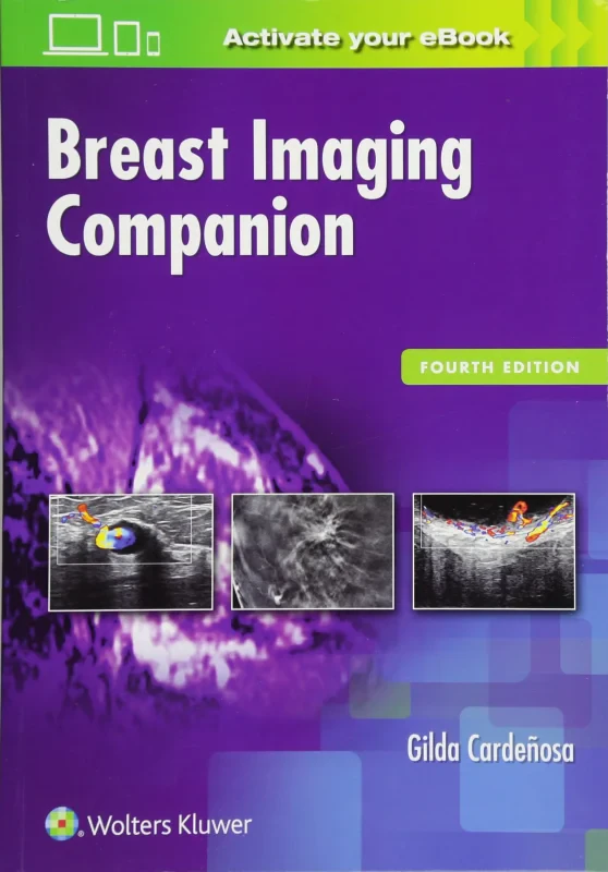 Coperta cărții "Breast Imaging Companion" de autor necunoscut