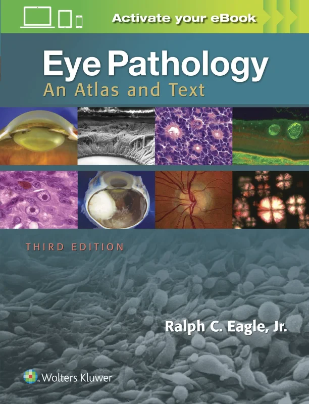 Coperta cărții "Eye Pathology: An Atlas and Text" de autor necunoscut