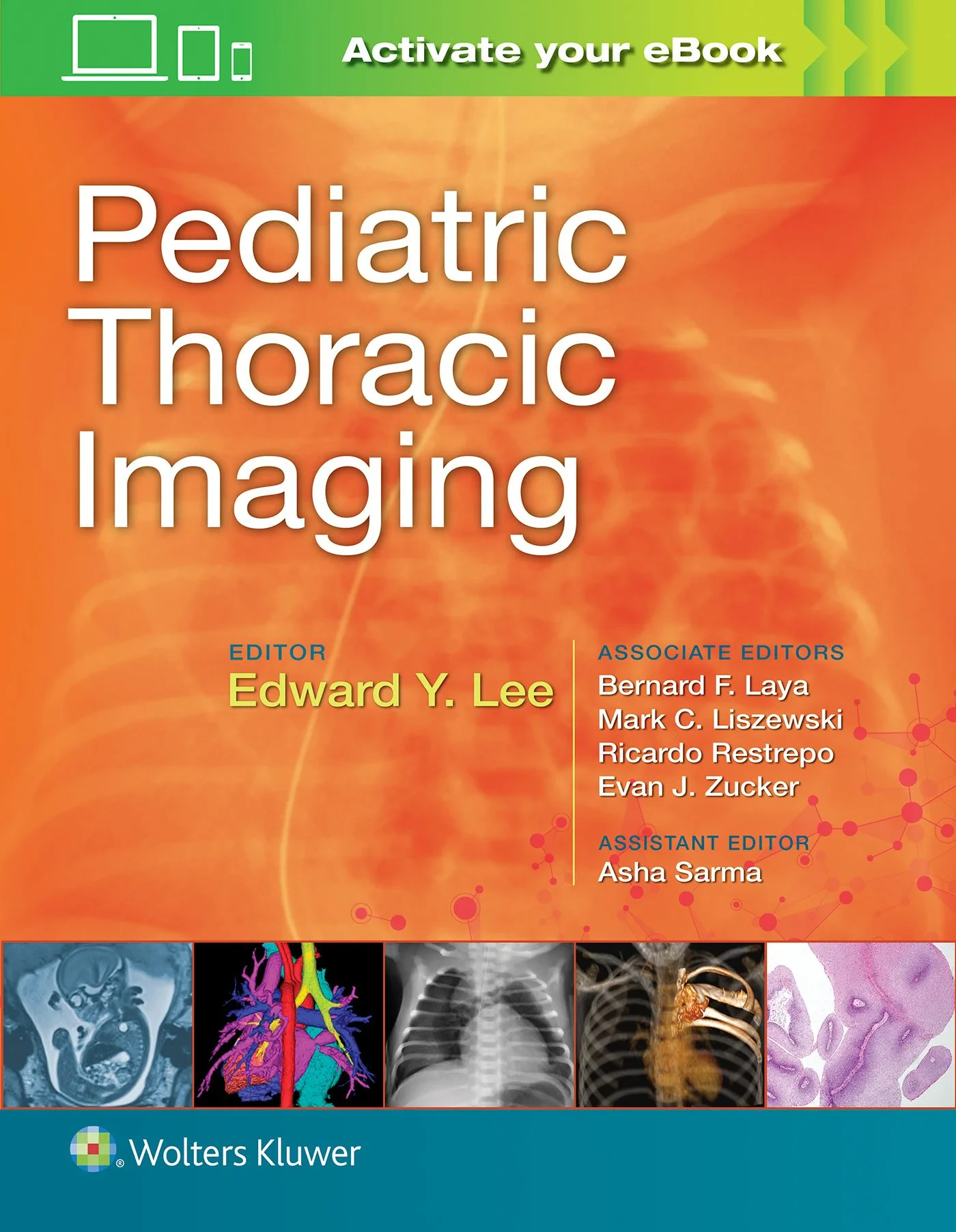 Coperta cărții "Pediatric Thoracic Imaging" de autor necunoscut