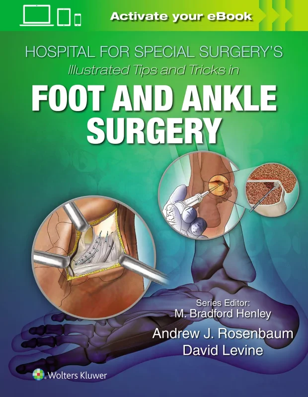 Coperta cărții "Hospital for Special Surgery's Illustrated Tips and Tricks in Foot and Ankle Surgery" de autor necunoscut