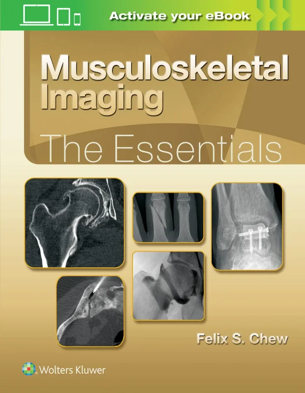 Coperta cărții "Musculoskeletal Imaging: The Essentials" de autor necunoscut