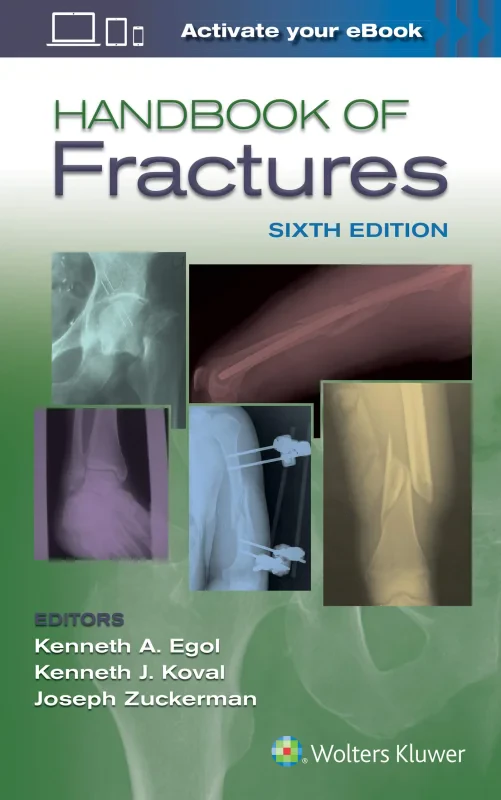 Coperta cărții "Handbook of Fractures" de autor necunoscut