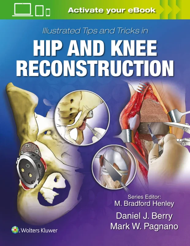 Coperta cărții "Illustrated Tips and Tricks in Hip and Knee Reconstructive and Replacement Surgery" de autor necunoscut
