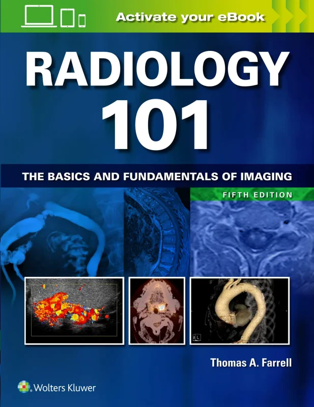 Coperta cărții "Radiology 101: The Basics and Fundamentals of Imaging" de autor necunoscut