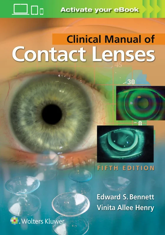 Coperta cărții "Clinical Manual of Contact Lenses" de autor necunoscut