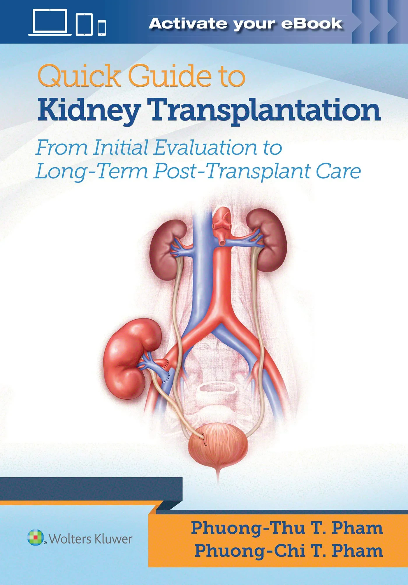 Coperta cărții "Quick Guide to Kidney Transplantation" de autor necunoscut