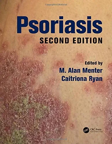 Coperta cărții "Psoriasis, Second Edition" de autor necunoscut