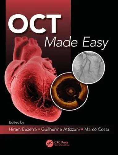 Coperta cărții "OCT Made Easy" de autor necunoscut