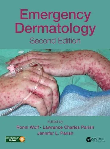 Coperta cărții "Emergency Dermatology, Second Edition" de autor necunoscut