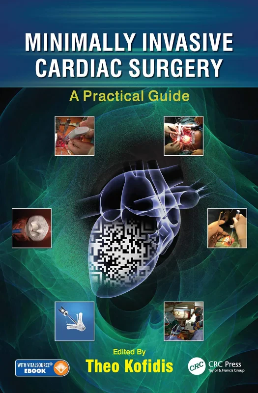 Coperta cărții "Minimally Invasive Cardiac Surgery: A Practical Guide" de autor necunoscut
