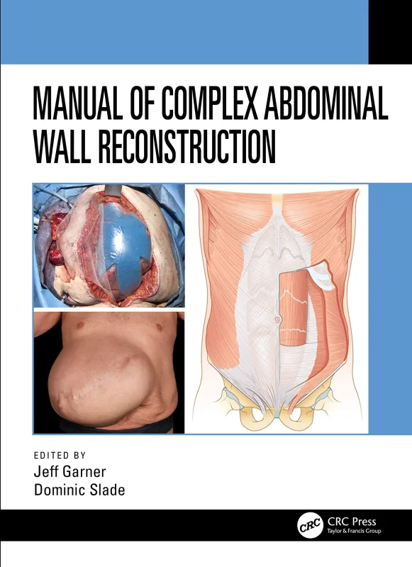 Coperta cărții "Manual of Complex Abdominal Wall Reconstruction" de autor necunoscut
