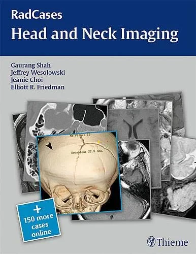 Coperta cărții "Head and Neck Imaging (Radcases Plus Q&amp;A)" de autor necunoscut