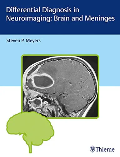 Coperta cărții "Differential Diagnosis in Neuroimaging: Brain and Meninges" de autor necunoscut