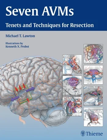 Coperta cărții "Seven AVMs" de autor necunoscut