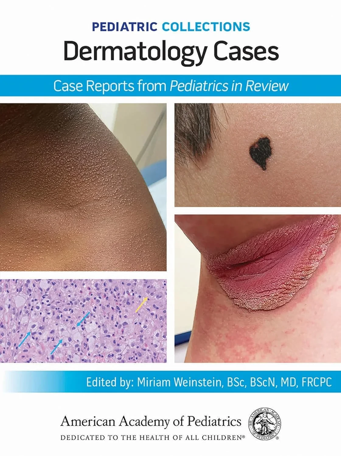 Coperta cărții "Pediatric Collections: Dermatology Cases" de autor necunoscut