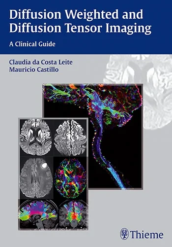 Coperta cărții "Diffusion Weighted and Diffusion Tensor Imaging: A Clinical Guide" de autor necunoscut