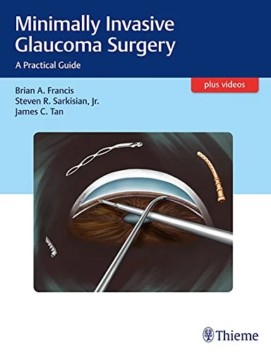 Coperta cărții "Minimally Invasive Glaucoma Surgery: A Practical Guide" de autor necunoscut