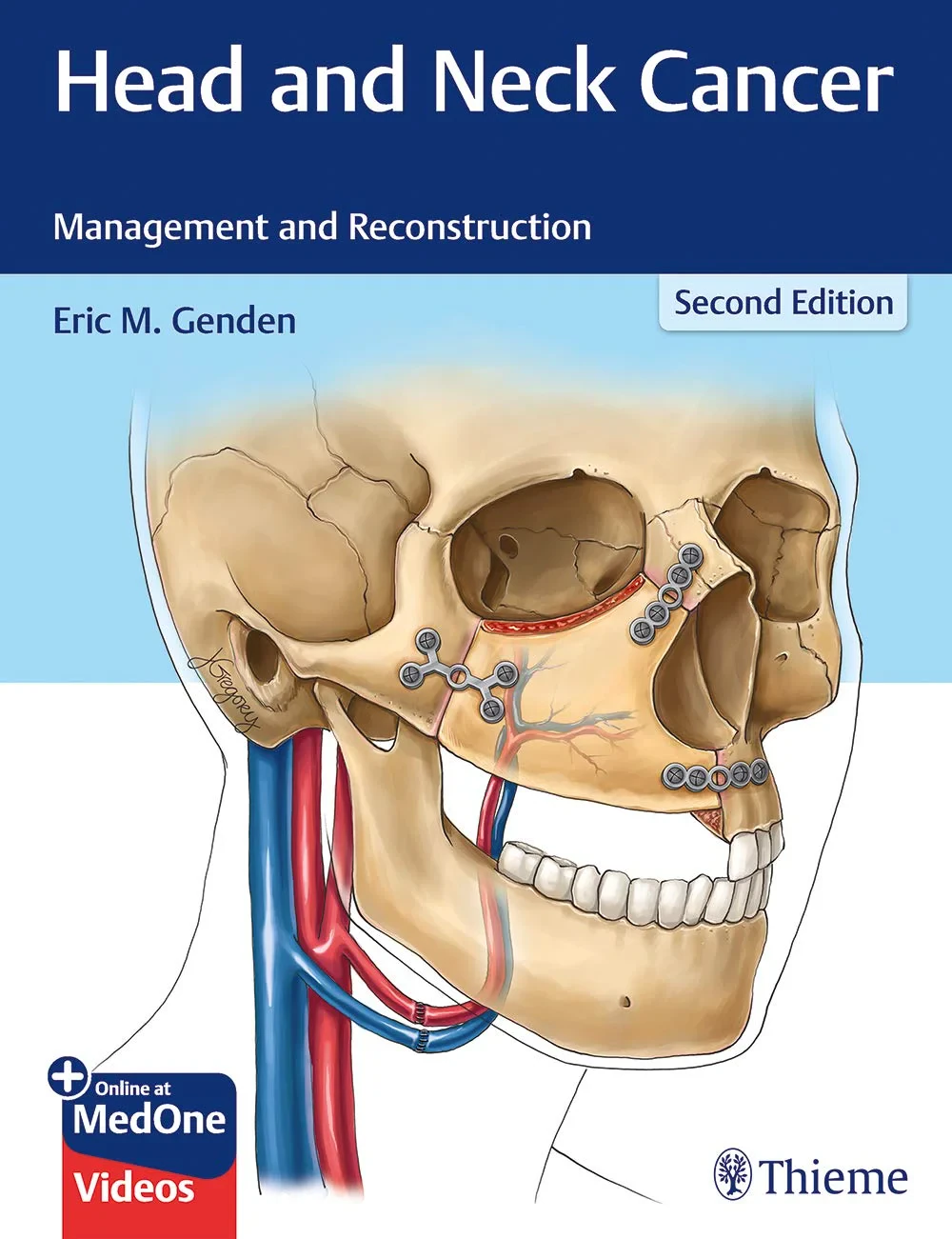 Coperta cărții "Head and Neck Cancer: Management and Reconstruction" de autor necunoscut