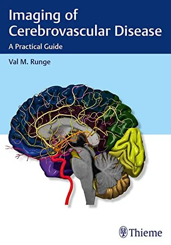 Coperta cărții "Imaging of Cerebrovascular Disease" de autor necunoscut