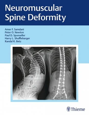 Coperta cărții "Neuromuscular Spine Deformity" de autor necunoscut