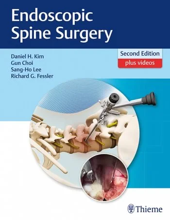 Coperta cărții "Endoscopic Spine Surgery" de autor necunoscut