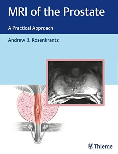 Coperta cărții "MRI of the Prostate: A Practical Approach" de autor necunoscut