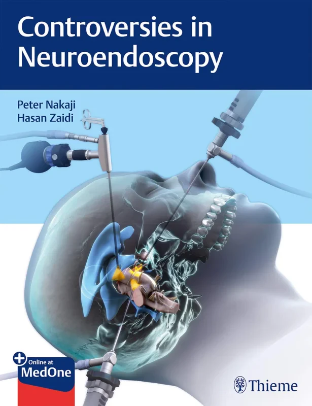 Coperta cărții "Controversies in Neuroendoscopy" de autor necunoscut
