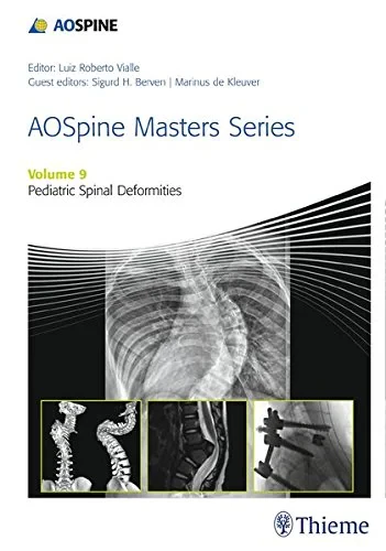 Coperta cărții "AOSpine Masters Series, Volume 9: Pediatric Spinal Deformities" de autor necunoscut