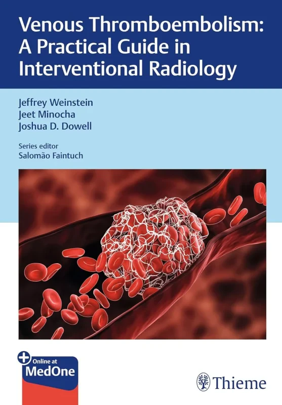 Coperta cărții "Venous Thromboembolism: A Practical Guide in Interventional Radiology" de autor necunoscut