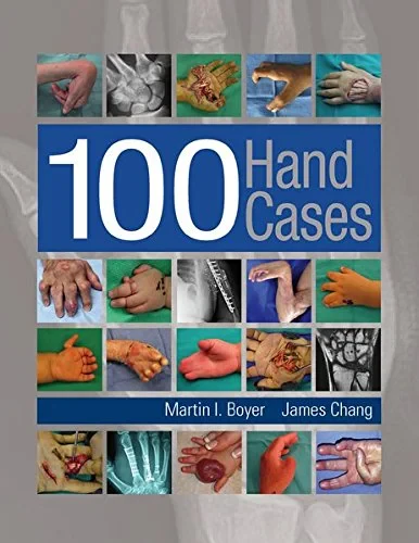 Coperta cărții "100 Hand Cases" de autor necunoscut