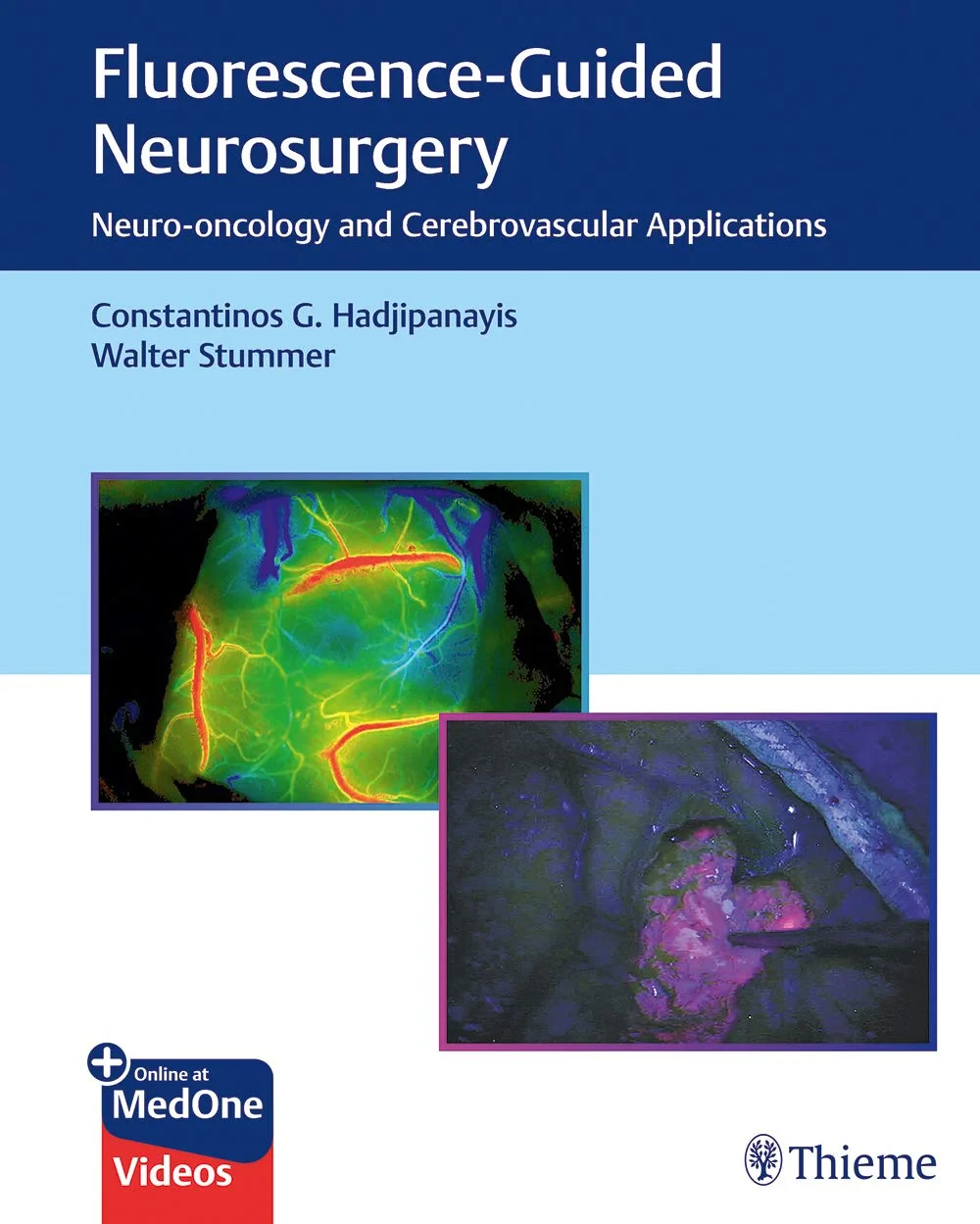 Coperta cărții "Fluorescence-Guided Neurosurgery: Neuro-oncology and Cerebrovascular Applications" de autor necunoscut