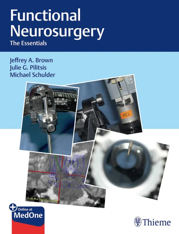 Coperta cărții "Functional Neurosurgery: The Essentials" de autor necunoscut