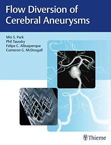 Coperta cărții "Flow Diversion of Cerebral Aneurysms" de autor necunoscut