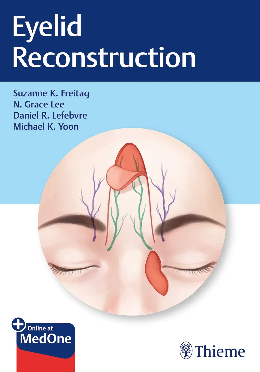Coperta cărții "Eyelid Reconstruction" de autor necunoscut