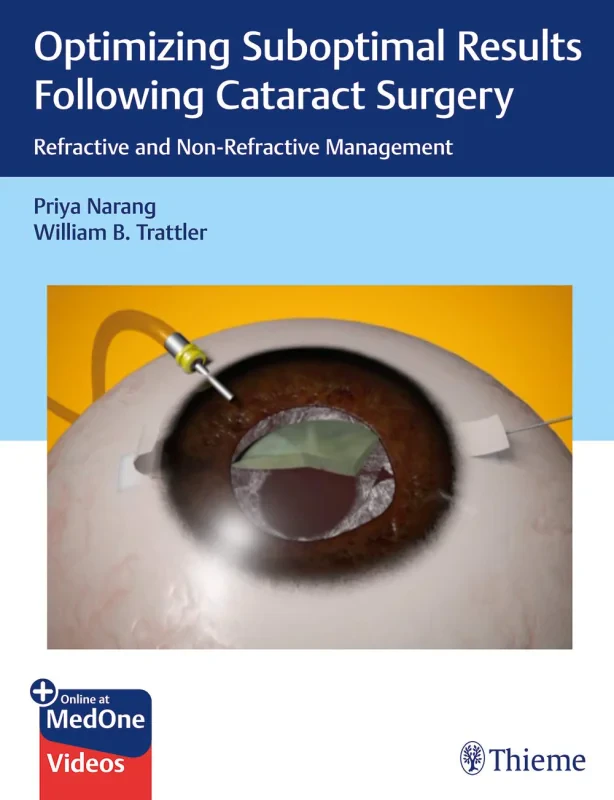 Coperta cărții "Optimizing Suboptimal Results Following Cataract Surgery: Refractive and Non-Refractive Management" de autor necunoscut