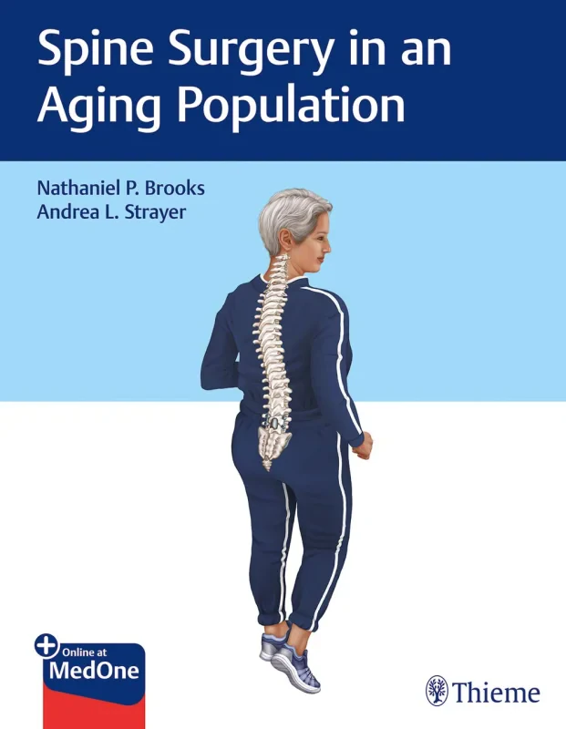 Coperta cărții "Spine Surgery in an Aging Population" de autor necunoscut