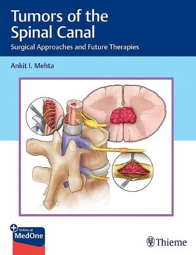 Coperta cărții "Tumors of the Spinal Canal: Surgical Approaches and Future Therapies" de autor necunoscut