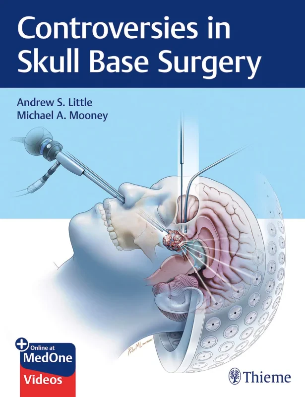 Coperta cărții "Controversies in Skull Base Surgery" de autor necunoscut