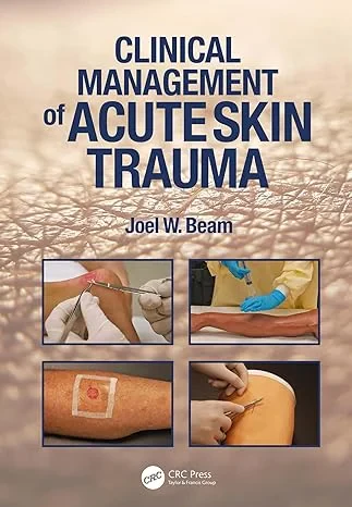 Coperta cărții "Clinical Management of Acute Skin Trauma" de autor necunoscut