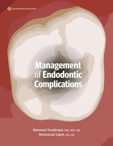 Coperta cărții "Management of Endodontic Complications" de autor necunoscut