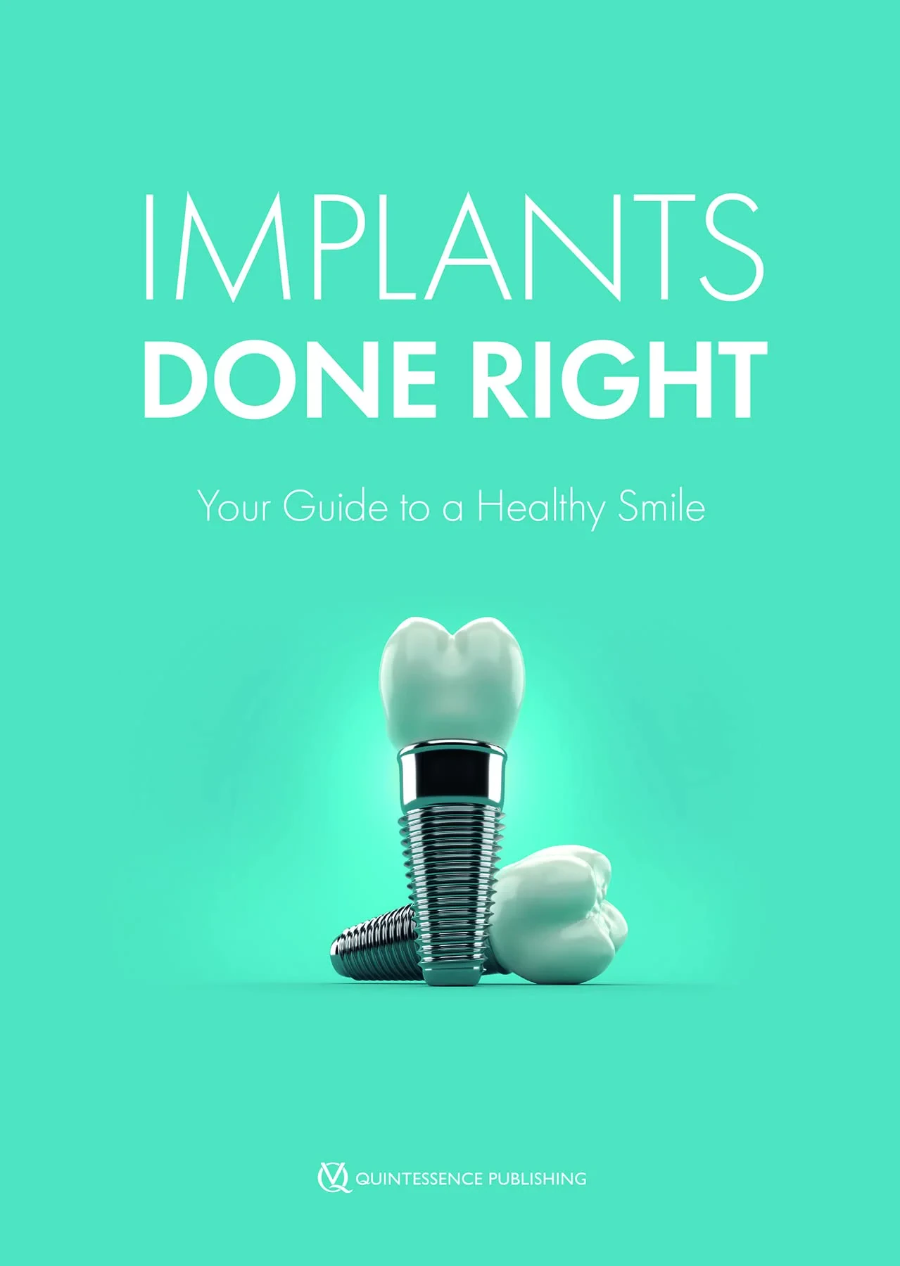Coperta cărții "Implants Done Right: Your Guide to a Healthy Smile" de autor necunoscut