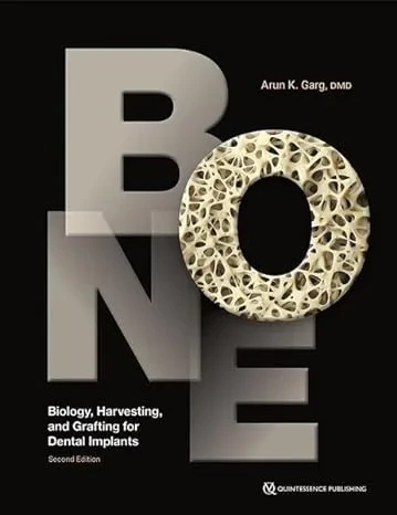 Coperta cărții "Bone. Biology, Harvesting, and Grafting for Dental Implants" de autor necunoscut