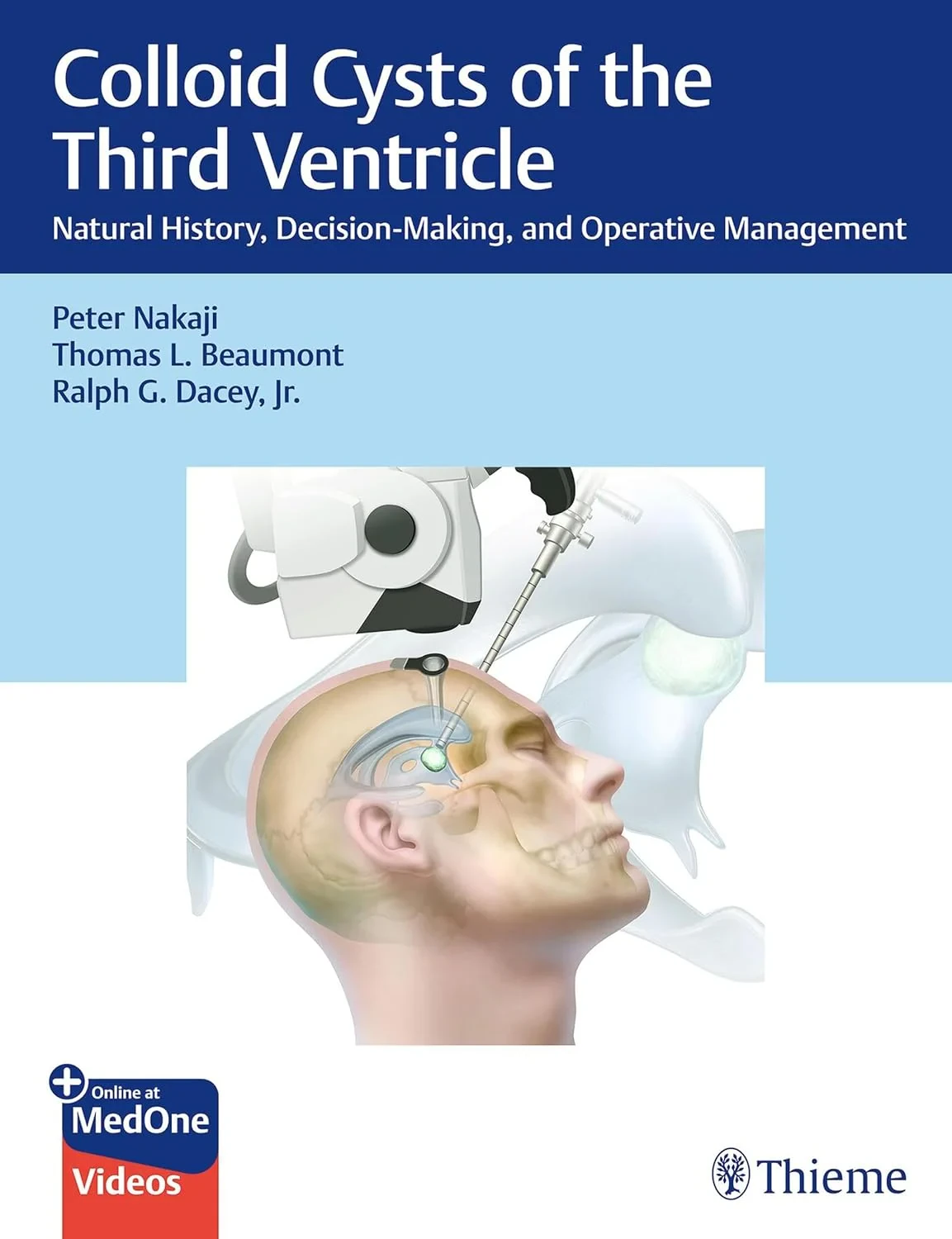Coperta cărții "Colloid Cysts of the Third Ventricle: Natural History, Decision-Making, and Operative Management" de autor necunoscut