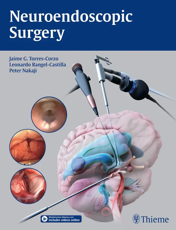 Coperta cărții "Neuroendoscopic Surgery" de autor necunoscut