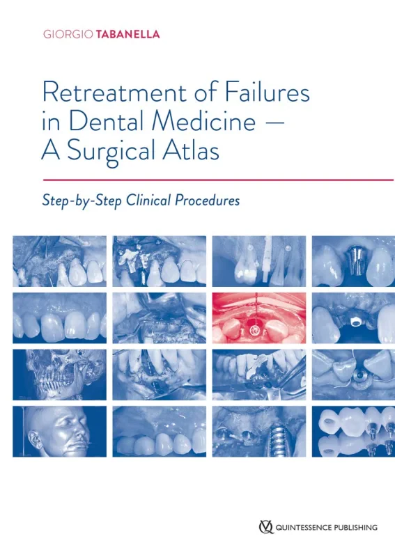 Coperta cărții "Retreatment of Failures in Dental Medicine - A Surgical Atlas: Step-by-Step Clinical Procedures" de autor necunoscut