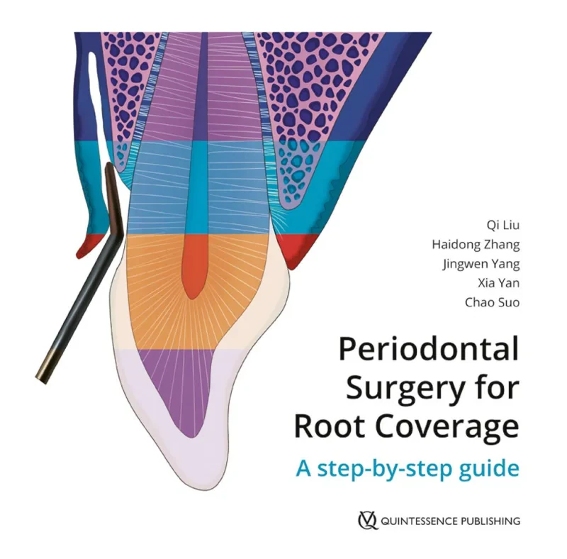 Coperta cărții "Periodontal Surgery for Root Coverage: A step-by-step guide" de autor necunoscut