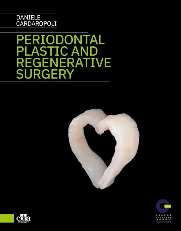 Coperta cărții "Periodontal plastic and regenerative surgery" de autor necunoscut